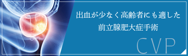バナーCVP